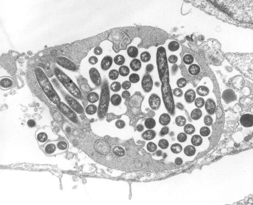 Filter contamination photo 02 Legionella in Amoeba