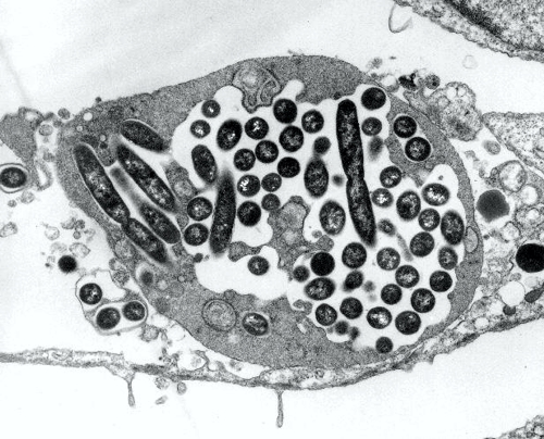 LegionellaPneumophila_Weikipedia 500